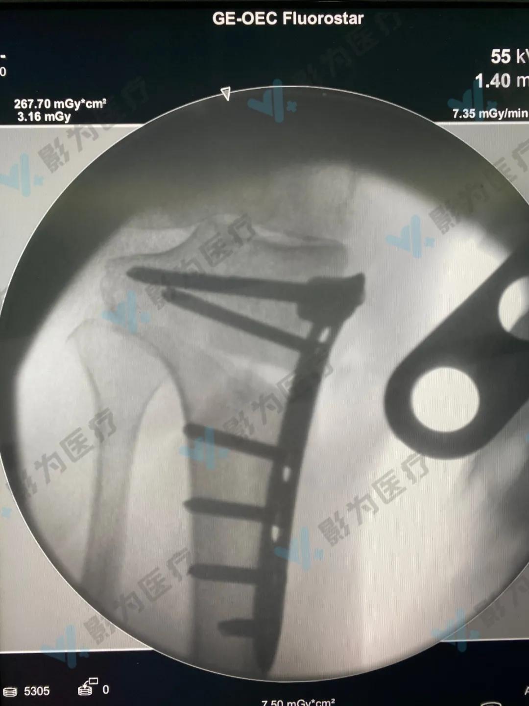 安医大阜阳附属医院减重,阜阳市颍州区安医大附属阜阳医院