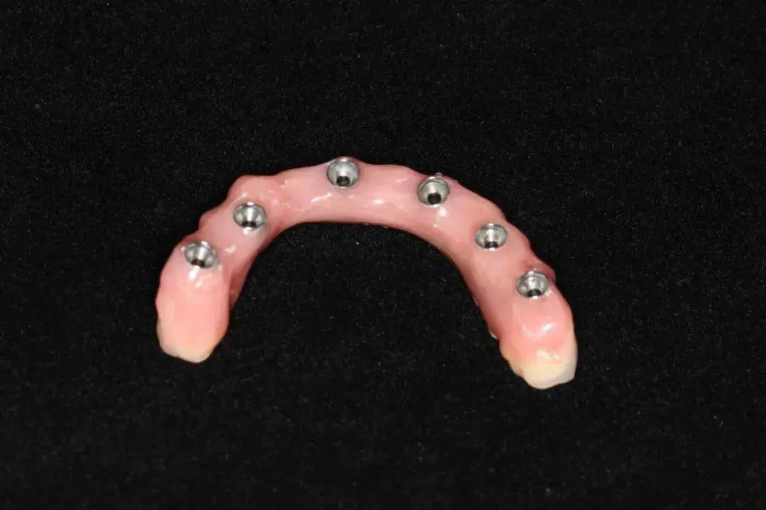 重庆医科大学附属口腔医院种植科,重庆市口腔医院种植科医生