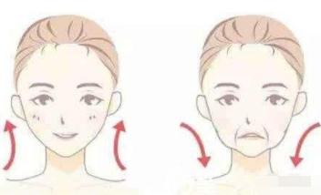法令纹又深又长最好的解决办法,法令纹最显老怎么去除法令纹