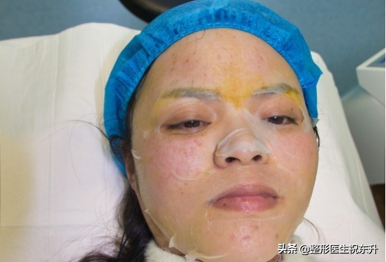 没做过“水光针”的人，听我谈谈真实的感受