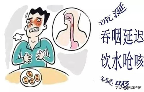 帕金森综合征出现吞咽困难用药,帕金森病人吞咽困难怎么去治疗