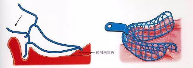 咬合重建详细步骤,如何制作咬合模型