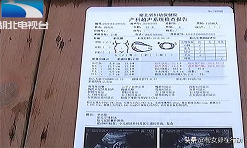 如果胎儿不是畸形医院给引产吗,胎儿有问题引产需要证明吗