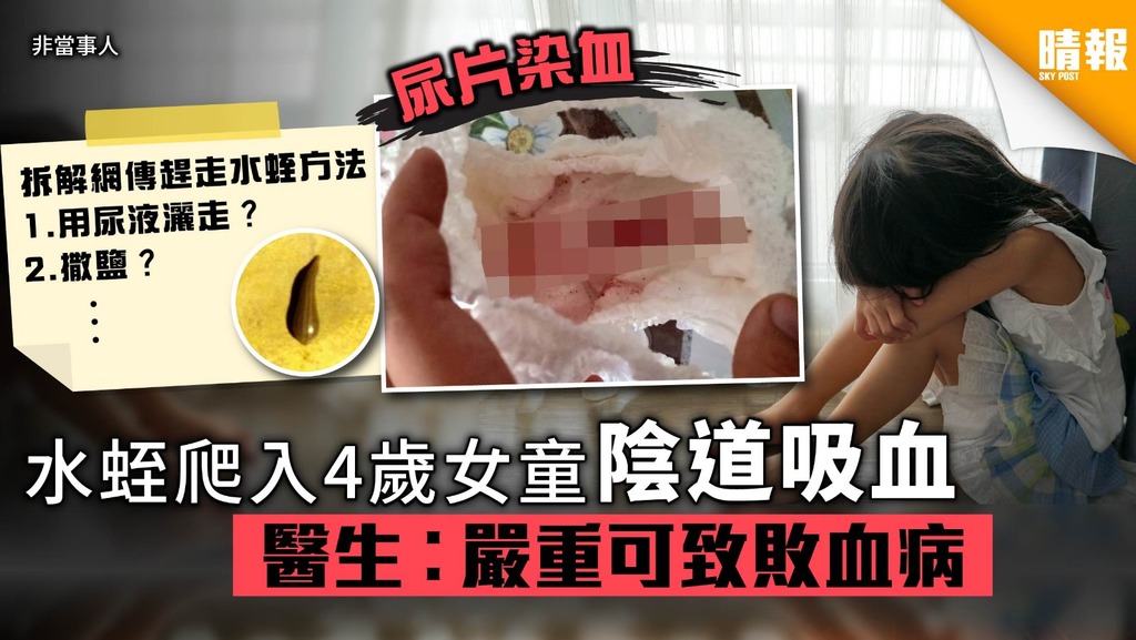 不小心把蚂蝗吞进肚子里会死吗,误吃蚂蟥在身体里能活吗