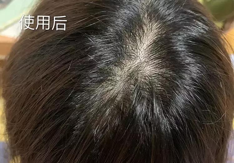 樱花头皮护理,樱花护发精油改善干枯防毛躁滋润