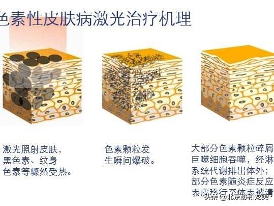 一擦祛斑靠谱吗,橡皮擦2秒祛斑能去掉斑吗