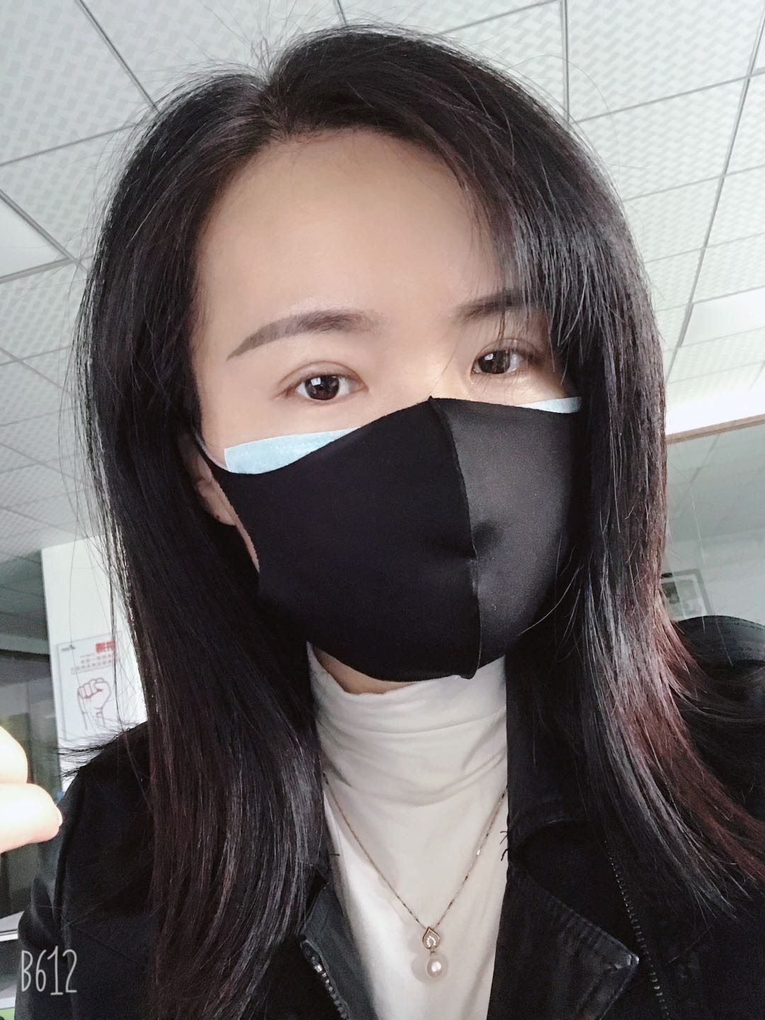 眼球突出割双眼皮好看吗,割双眼皮的危害