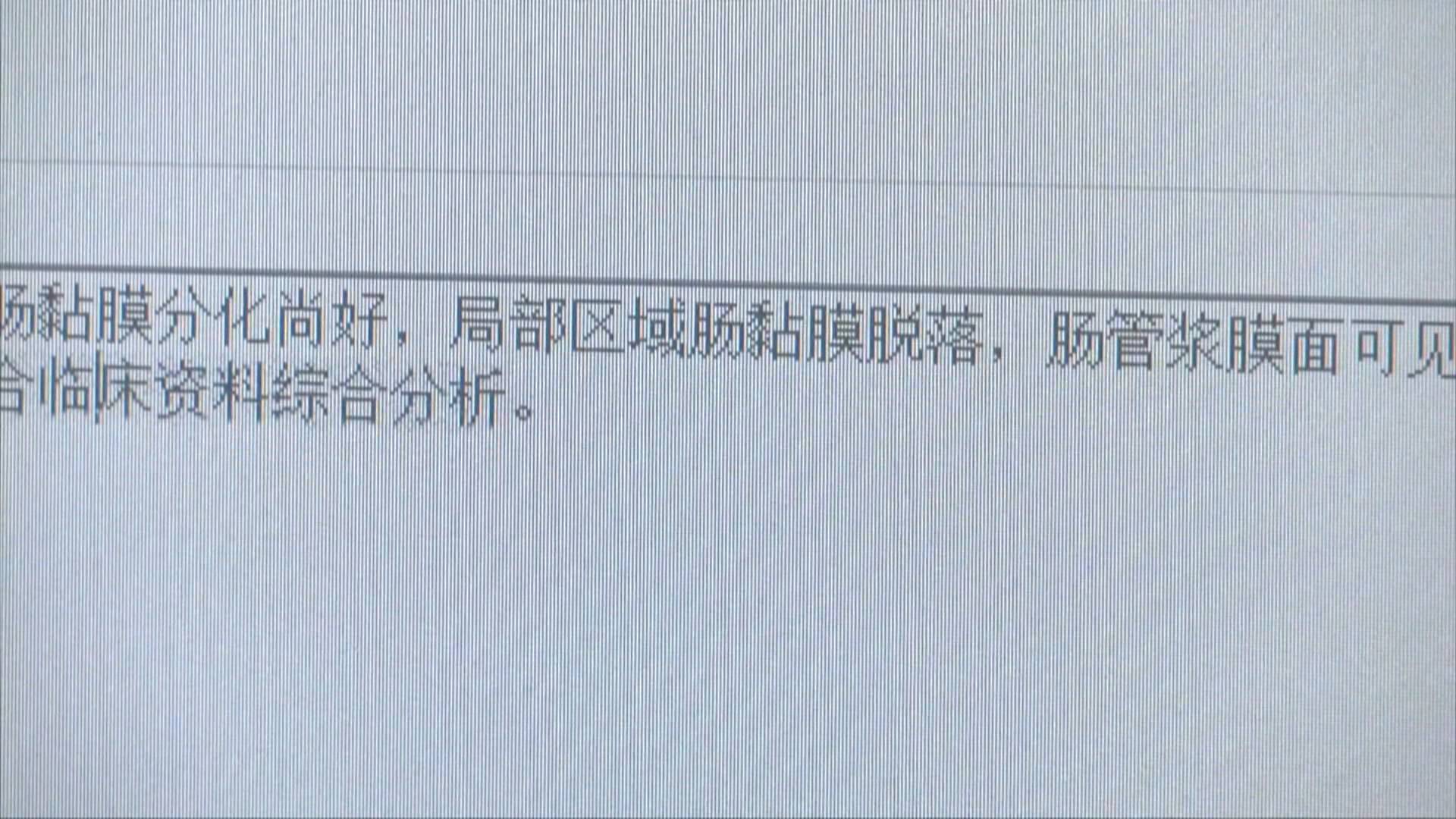老年人灌肠后多久能排便,长期灌肠排便对身体有什么危害