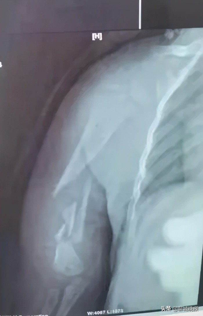 一岁多的聊城娃,牵动多地名医心