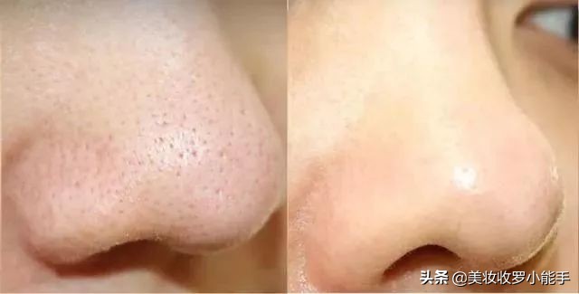 日本takami美容液,日本takami去角质调理液