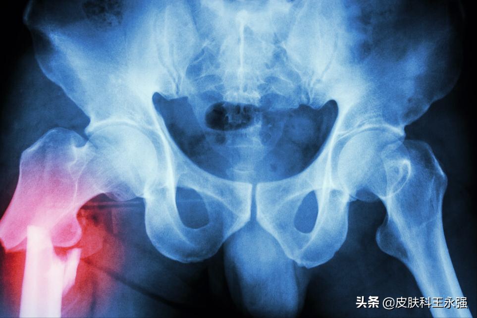 坐久了臀部疼肌肉劳损,久坐臀肌劳损怎么治