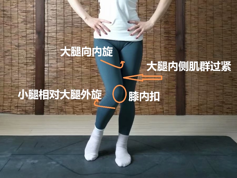 平时不经意的动作习惯让你的膝关节咔咔响和疼,生活中需这样保护