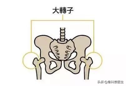 咳嗽引发坐骨神经痛啥原因,坐骨神经痛是什么原因引起的男士