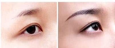 刚做完眉毛有点红,刚做完眉毛浓粗正常吗