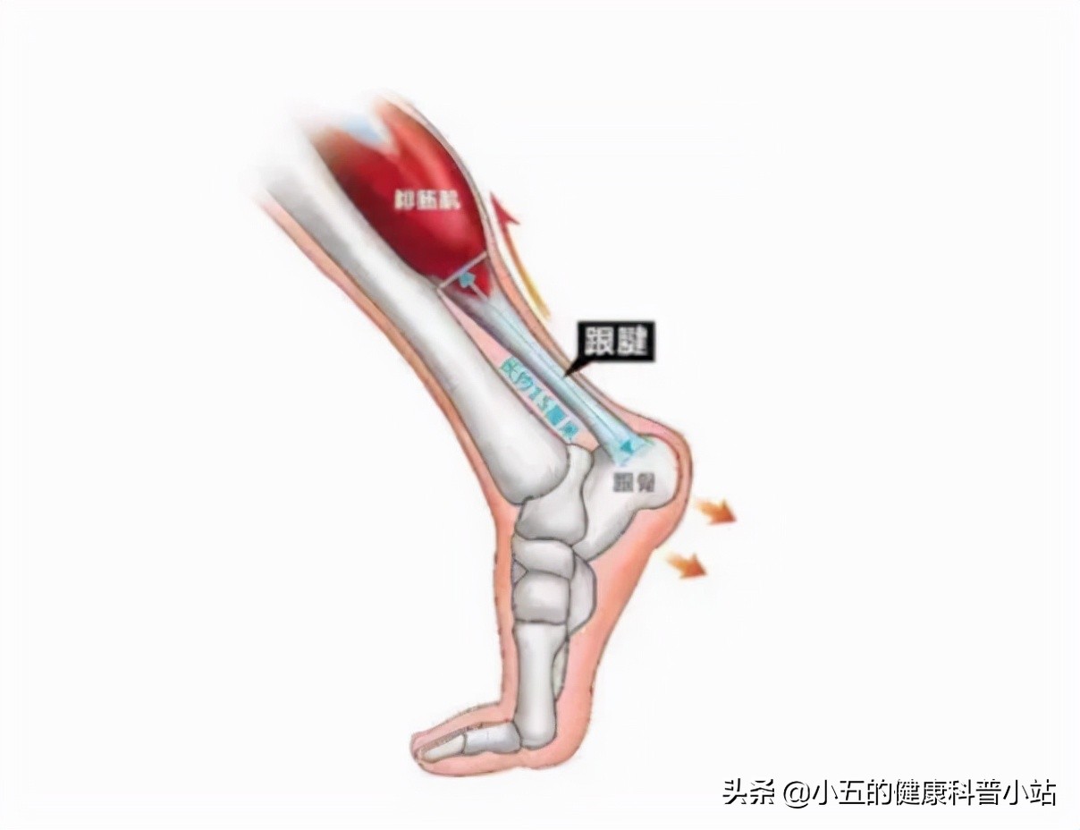 足跟痛是一个疾病征兆,足跟痛是什么疾病的前兆