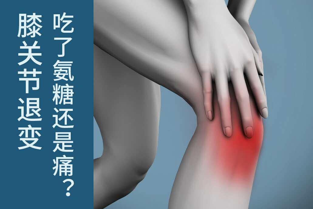 膝骨关节炎吃哪种氨糖好,中老年女性膝盖疼痛吃氨糖有用吗