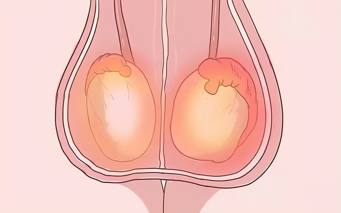 噗嗤一脚，我的蛋蛋被踹了