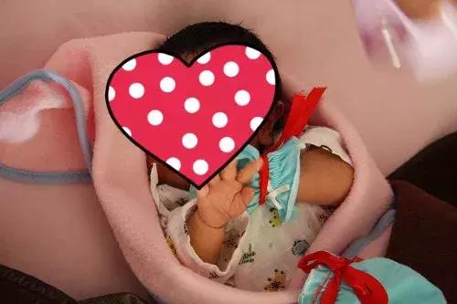 黄疸脑损伤能恢复正常吗,新生儿黄疸轻微脑损伤怎么治疗