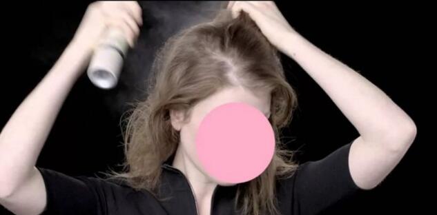 女生头发太贴头皮怎么处理,女生头发太少太软太贴头皮怎么办