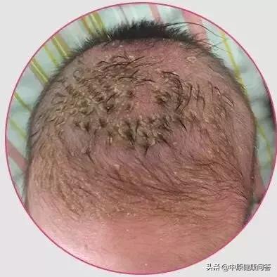 医院新生儿护理基本常识,学习新生儿护理全面知识