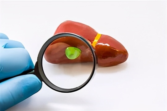 胆囊炎反复发作会变成癌症吗,胆囊结石胆囊炎诱发癌症几率大吗