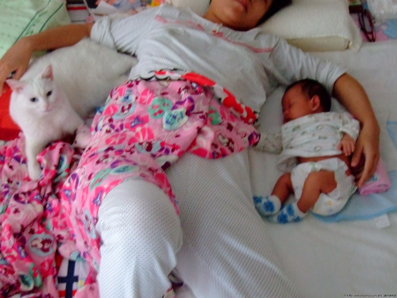 剖腹产疤痕增生一年了怎么去掉,剖腹产疤痕增生可以用中药包好吗