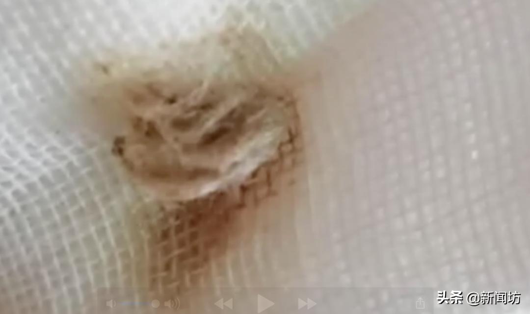 2岁女童*体下**间断性出血,还有异味!母亲怀疑性早熟,原因意外