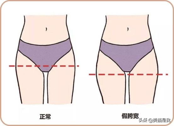 你不是腿短，而是加胯宽，科学矫正假垮宽，修炼长腿第一步！