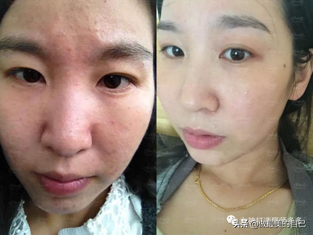 斑点暗黄肌最全的改善小技巧，都在这里