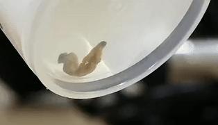 医生从人身上取出白色虫子,女子体内取出活虫只因爱吃这样菜