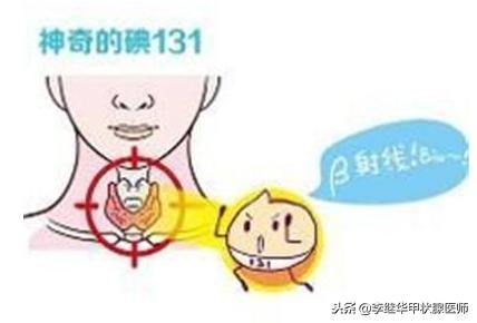 甲亢患者如何正确选择治疗方法？