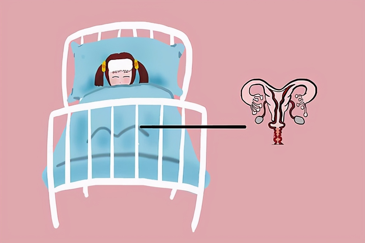 妇科检查，查出盆腔积液，要治疗吗？严重不严重？医生明确告诉你