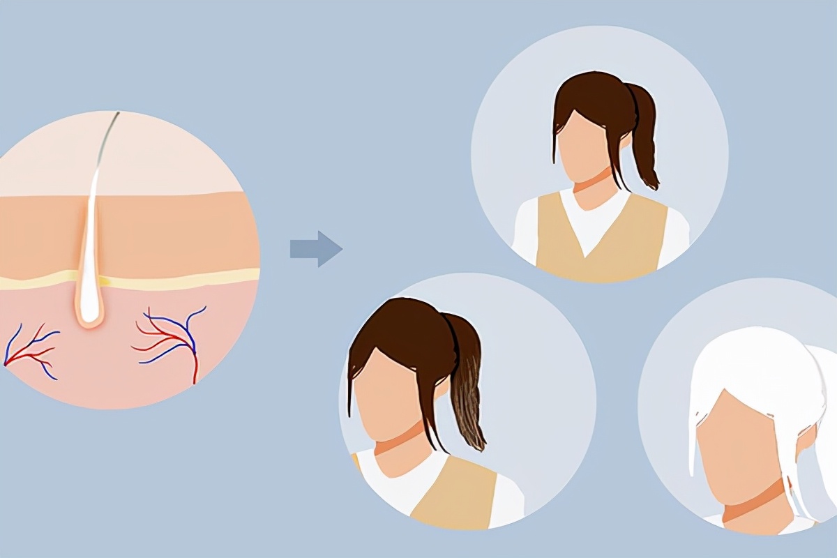 女性突然长出白发，是变老了吗？不一定，也可能是身体缺4种营养