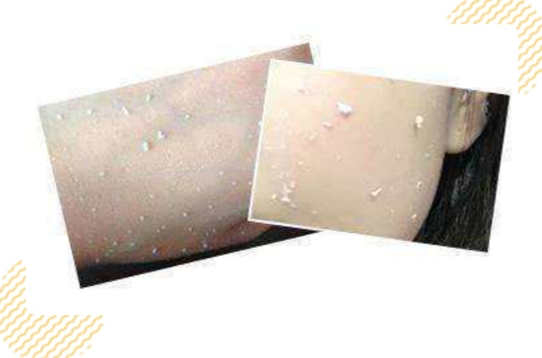 去角质的正确使用方法和步骤,角质层薄用什么去角质比较好