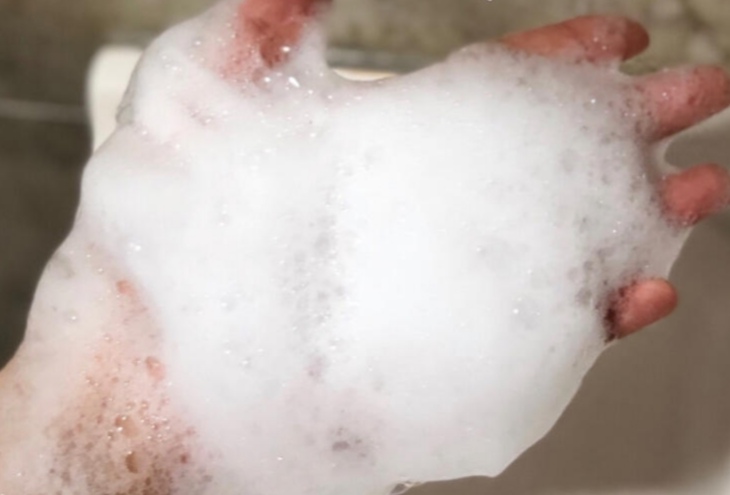 4种去屑控油洗发水,去屑止痒控油洗发水大瓶推荐