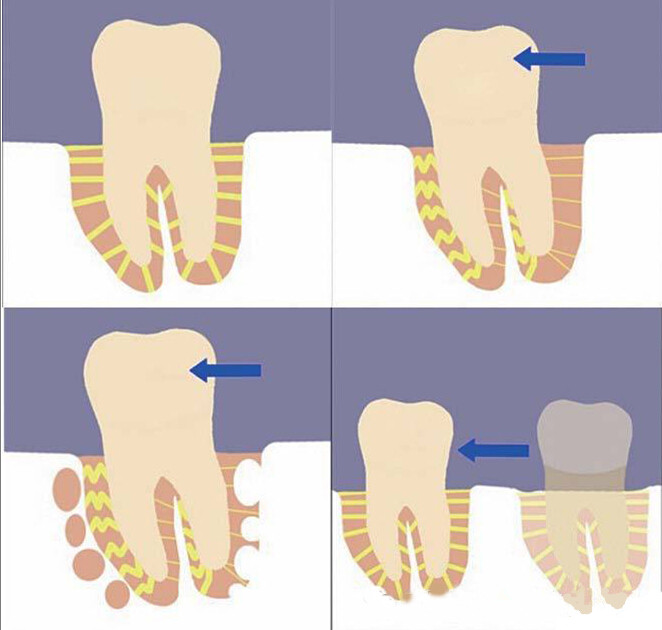 更年期牙齿松动酸痛是什么原因,牙齿松动酸痛服用什么药有效