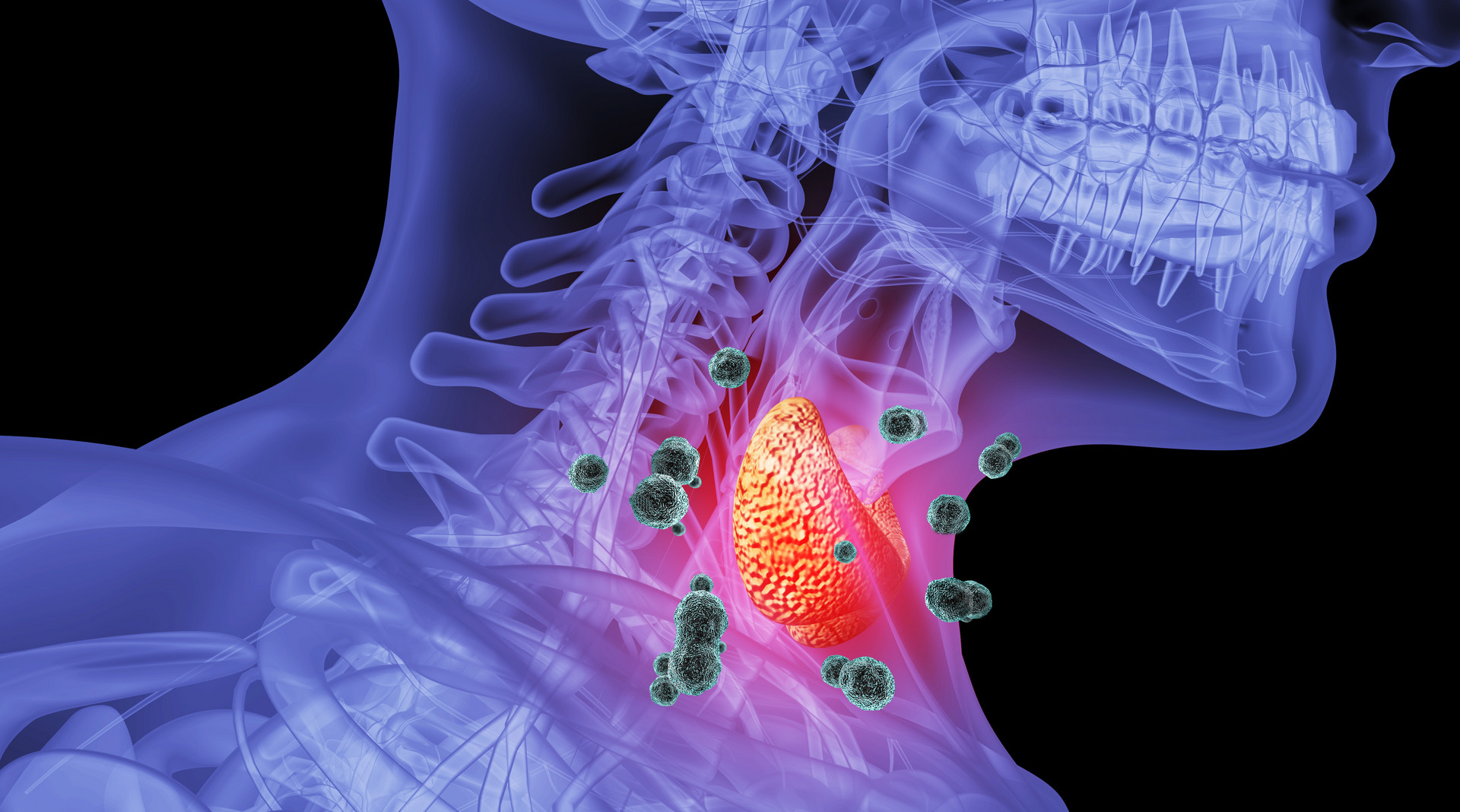 麦迪森健康,麦迪森治疗近视