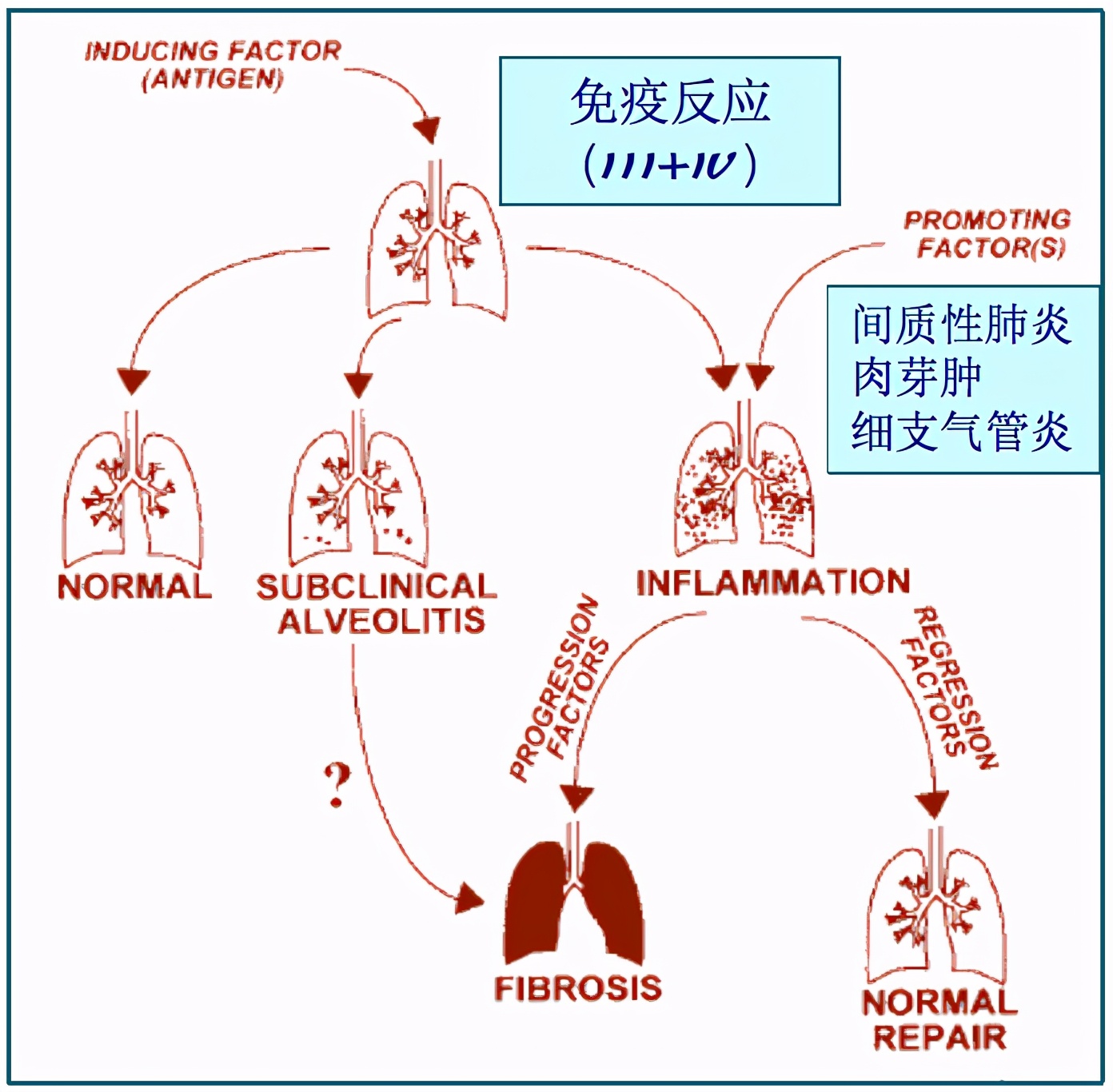 养鸽子造成皮肤真菌感染,养鸽子会得肺炎吗