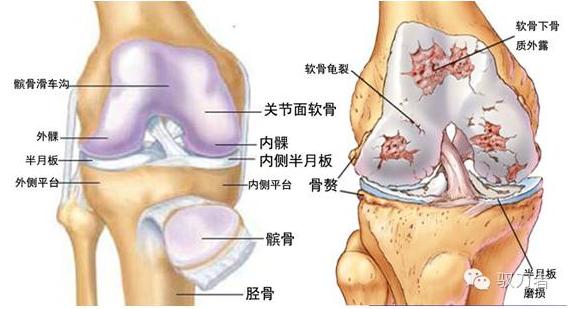 膝关节骨性关节炎症状及治疗,膝关节骨性关节炎诊疗指南下载