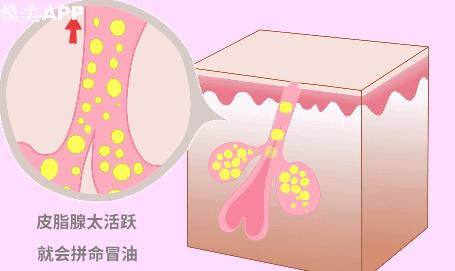 皮肤出油毛孔粗大如何改善,改善毛孔粗大出油用什么洗面奶