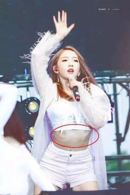 肋骨外翻且胸部突出,肋骨外翻导致胸突出