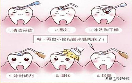 蛀牙如何避免踩坑,发现蛀牙了一周之后补来得及吗