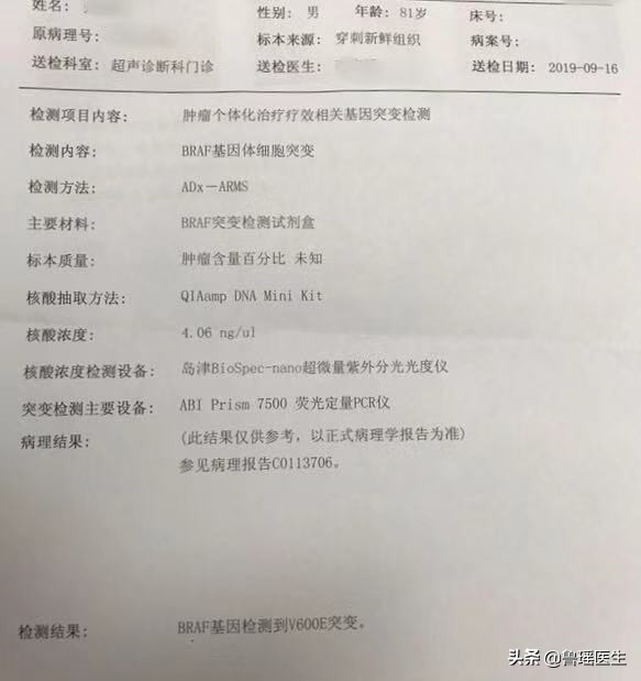 8旬老人甲状腺癌挤压气管向左侧移位术前评估中