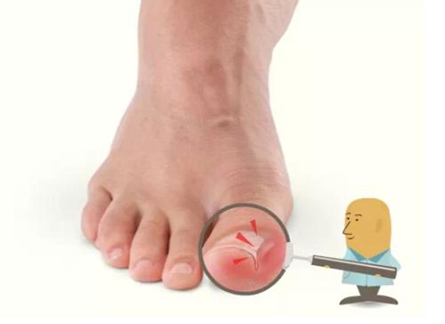 脚各个部位疼痛位置图解,脚疼和肿是什么原因