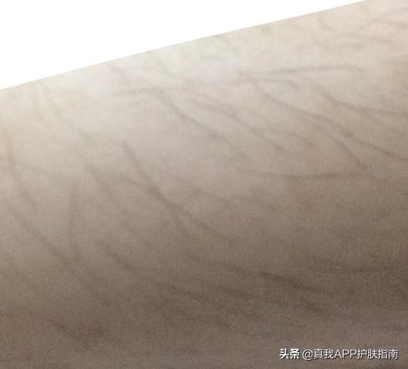 烟酰胺美白身体乳长毛吗,烟酰胺美白作用真的吗