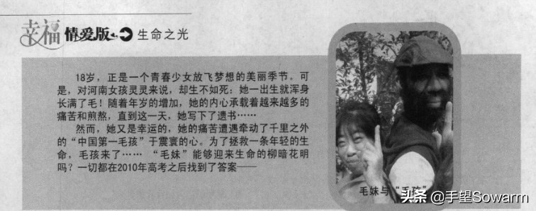 全世界体毛最多的人，是如何在歧视中逆袭为实力派歌手的？