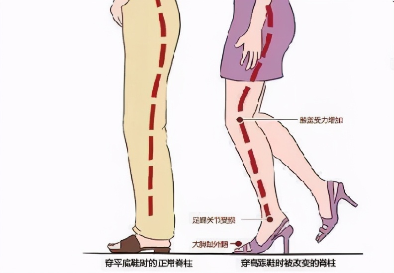 人未老膝盖先老,人未老脚先衰十个动作