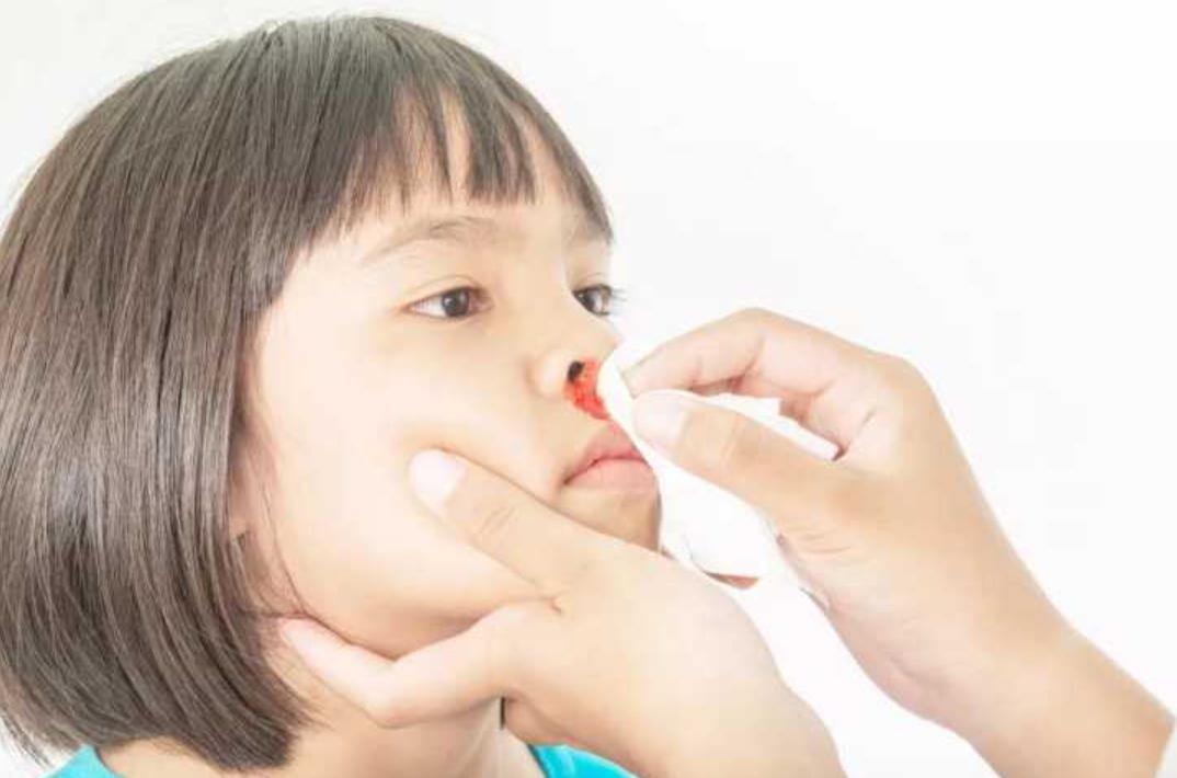 4岁男童鼻子渗血,五岁男童鼻流血不止抢救无效死亡