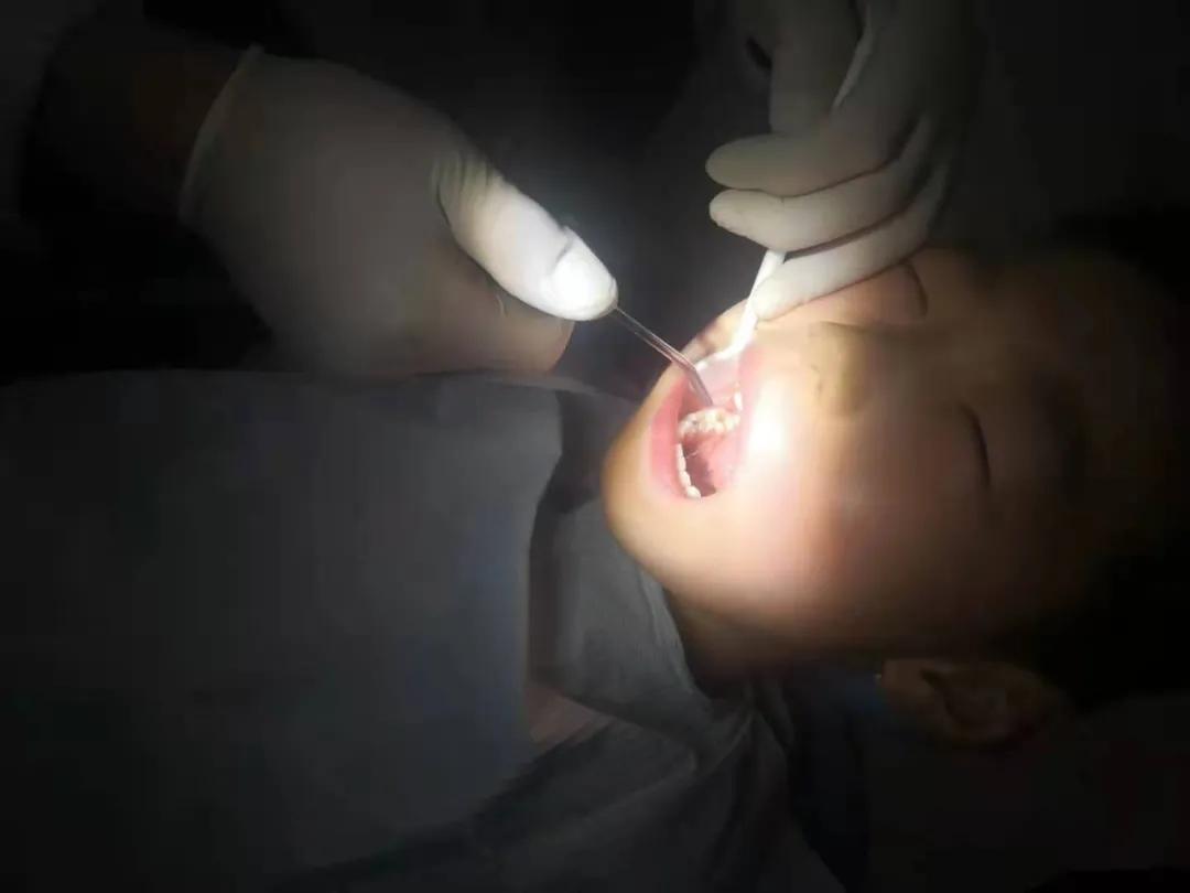 孩子吃糖牙疼怎么治,孩子吃糖牙疼怎么快速缓解