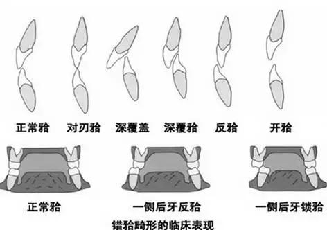 helen鐗欑涓績鍥剧墖,helen榻跨